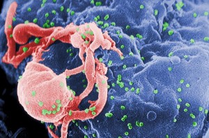 HIV-AIDS-ایدز 