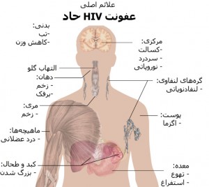 HIV-AIDS-ایدز یمارستان-درمانگاه-رادیولوژی-داروخانه-کلینیک-bimarestan-hospital-(www.marizkhone.com)(7)